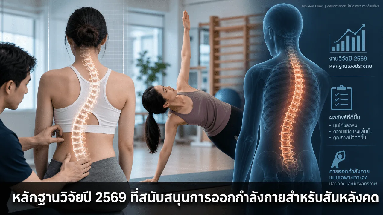 หลักฐานวิจัยปี 2569 ที่สนับสนุนการออกกำลังกายสำหรับสันหลังคด