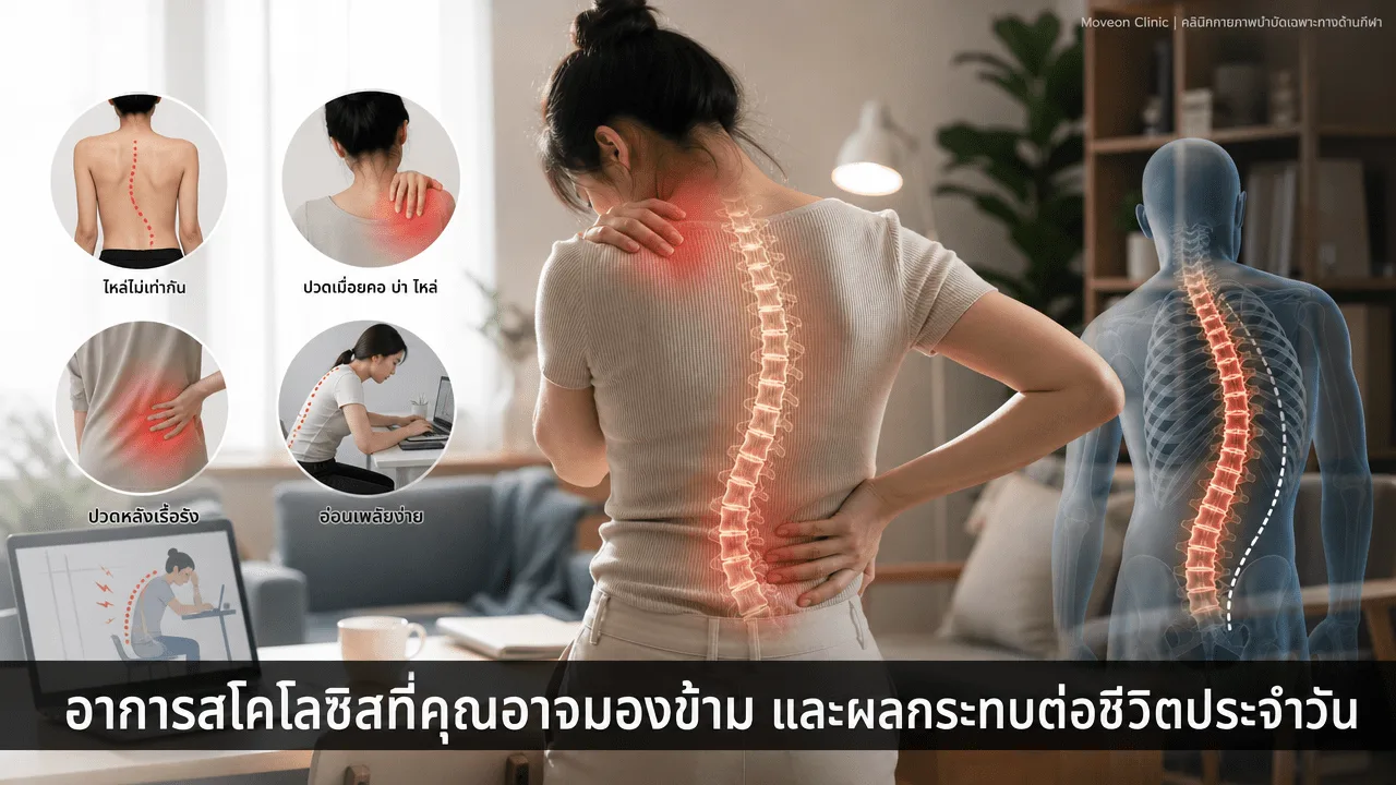 อาการสันหลังคดที่คุณอาจมองข้ามและผลกระทบต่อชีวิตประจำวัน